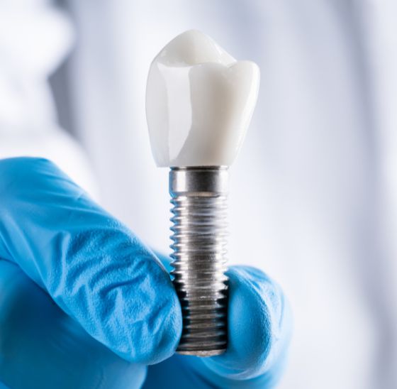 Tratamiento implantes dentales Innovación Dental Manzanares